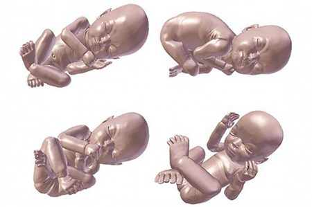 شرکت 3-D Babies با استفاده از تصاویر سه‌بعدی و چهاربعدی مدل واقعی جنین متولد نشده را با چاپگر سه‌بعدی تولید می‌کند