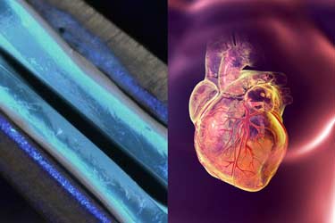 تولید رگ‌های خون‌رسان با چاپگر سه‌بعدی به کمک بیماران قلبی می‌آید