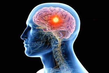 دستگاهی به شکل کلاه به کمک درمان سرطان مغز می‌آید